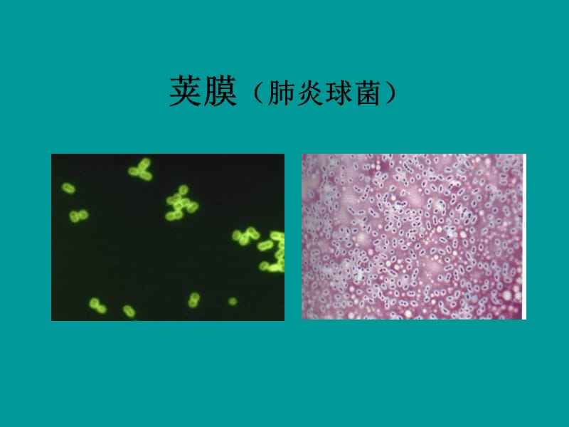 荚膜染色法 荚膜染色法