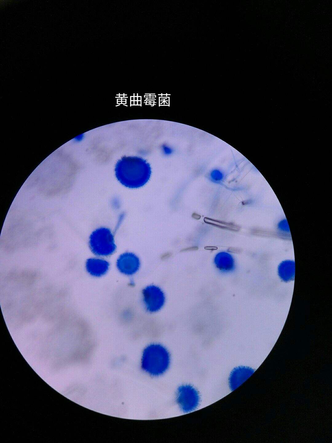 乳酸酚棉蓝染色法 乳酸酚棉蓝染色法