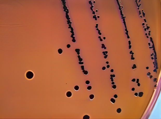 伊红美蓝琼脂 伊红美蓝琼脂